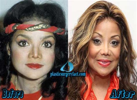 latoya jackson before plastic surgery|La Toya Jackson Plastic Surgery Before And After。